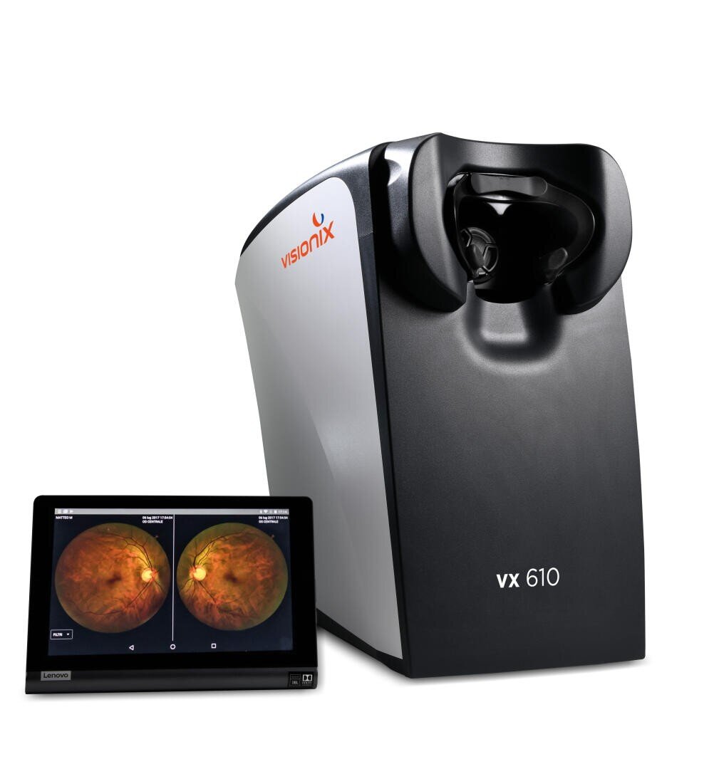 Ein Augenuntersuchungsgerät Visionix VX 610 befindet sich neben einem digitalen Bildschirm, auf dem zwei Netzhautbilder angezeigt werden, die detaillierte Ansichten des Augeninneren zeigen.