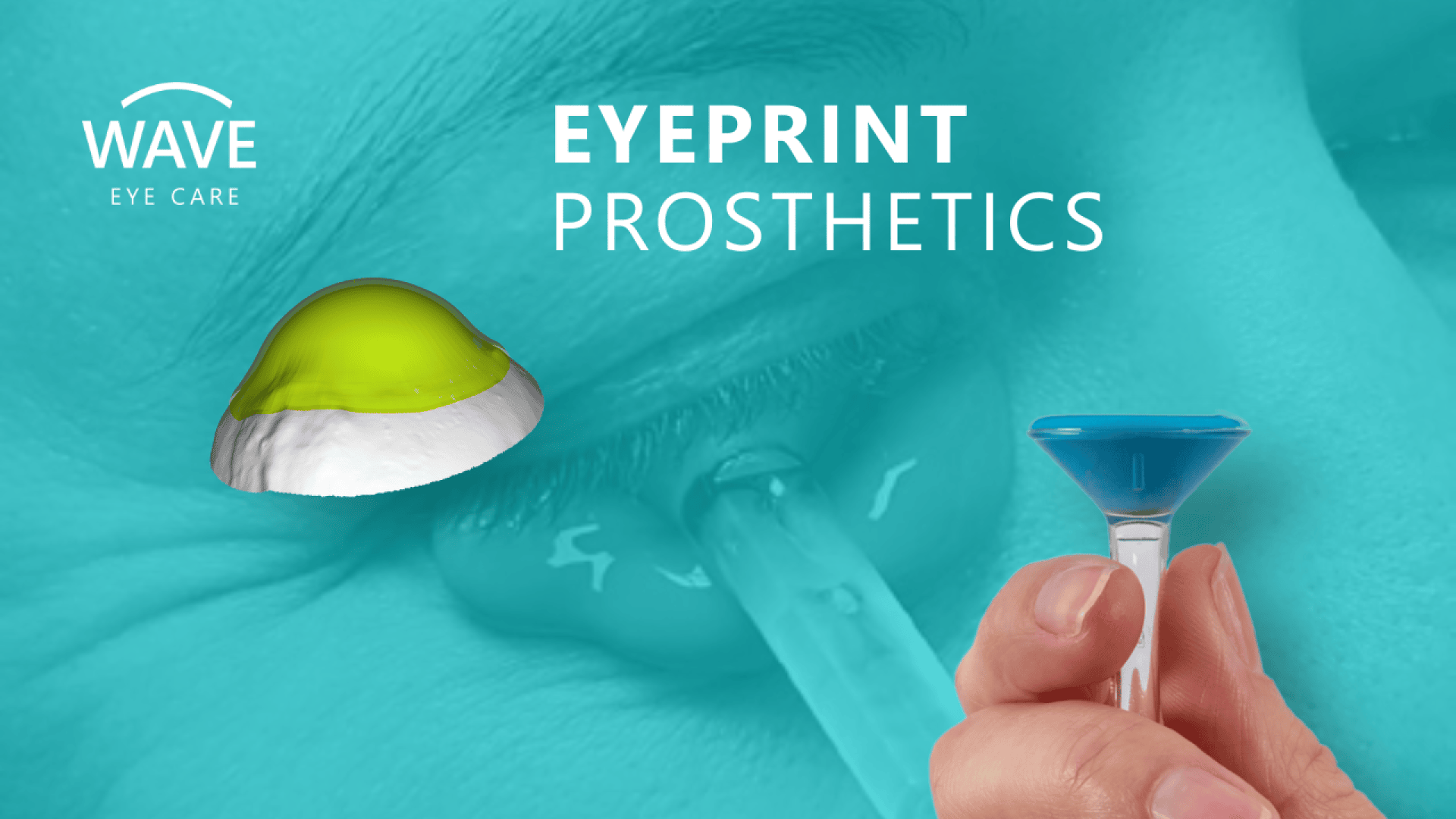 Nahaufnahme eines Auges bei der Anpassung einer Prothesenlinse, mit einer Hand, die ein blaues Werkzeug und ein digitales Modell einer maßgefertigten Linse hält. Der Text lautet WAVE EYE CARE EYEPRINT PROSTHETICS.