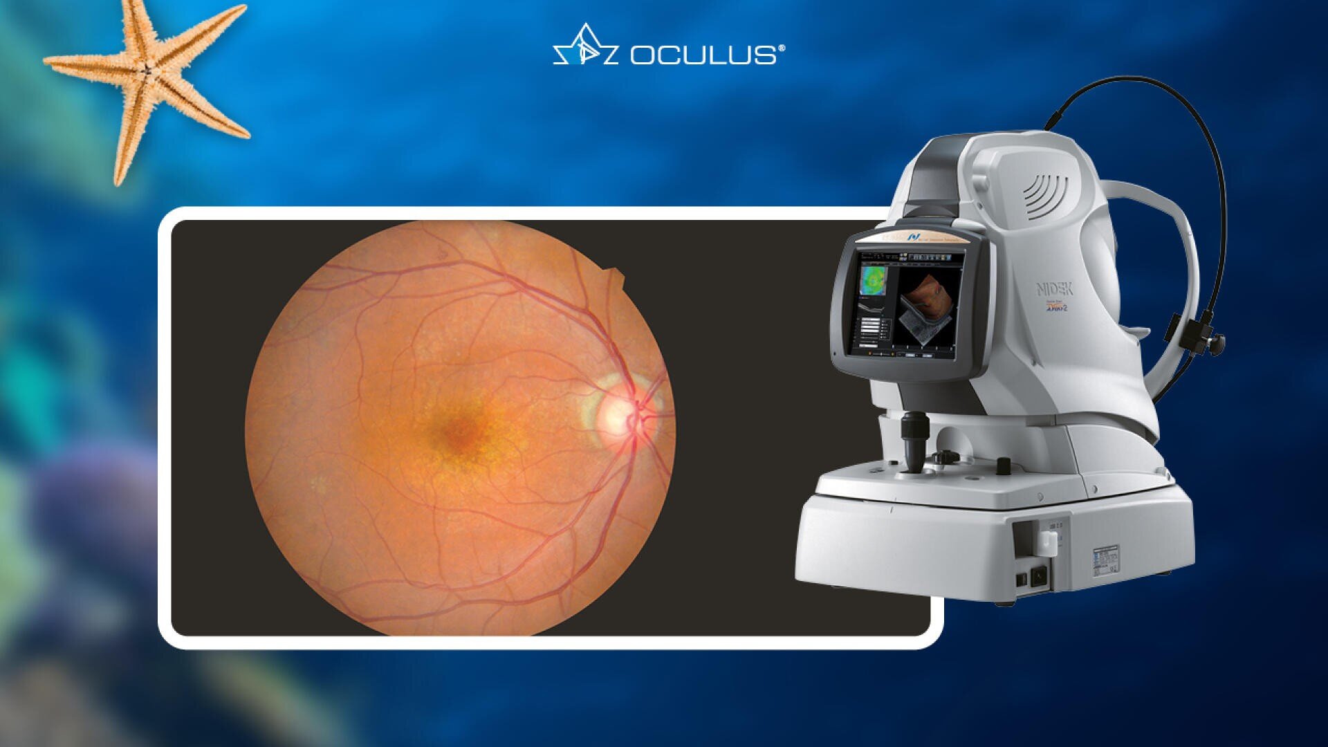 Ein medizinisches Netzhautbildgebungsgerät wird neben einem detaillierten Netzhautscan gezeigt. Der Hintergrund ist blau mit einem Oculus-Logo, und in der oberen linken Ecke ist ein Seestern zu sehen.