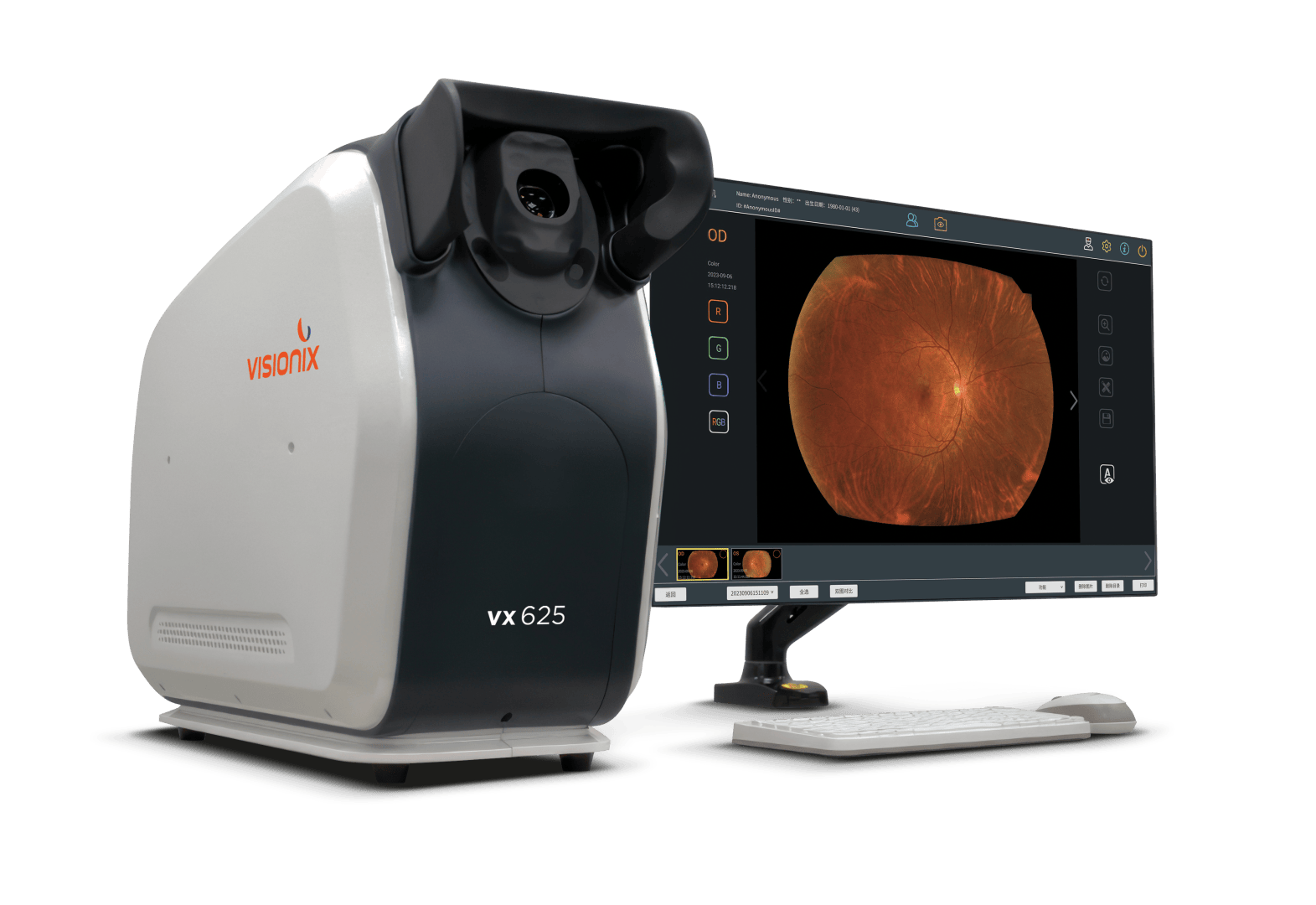 Ein Visionix VX 625 Augenaufnahmegerät steht neben einem Monitor, der einen detaillierten Netzhautscan anzeigt. Vor dem Bildschirm befinden sich eine Tastatur und eine Maus, alles vor einem schlichten Hintergrund.