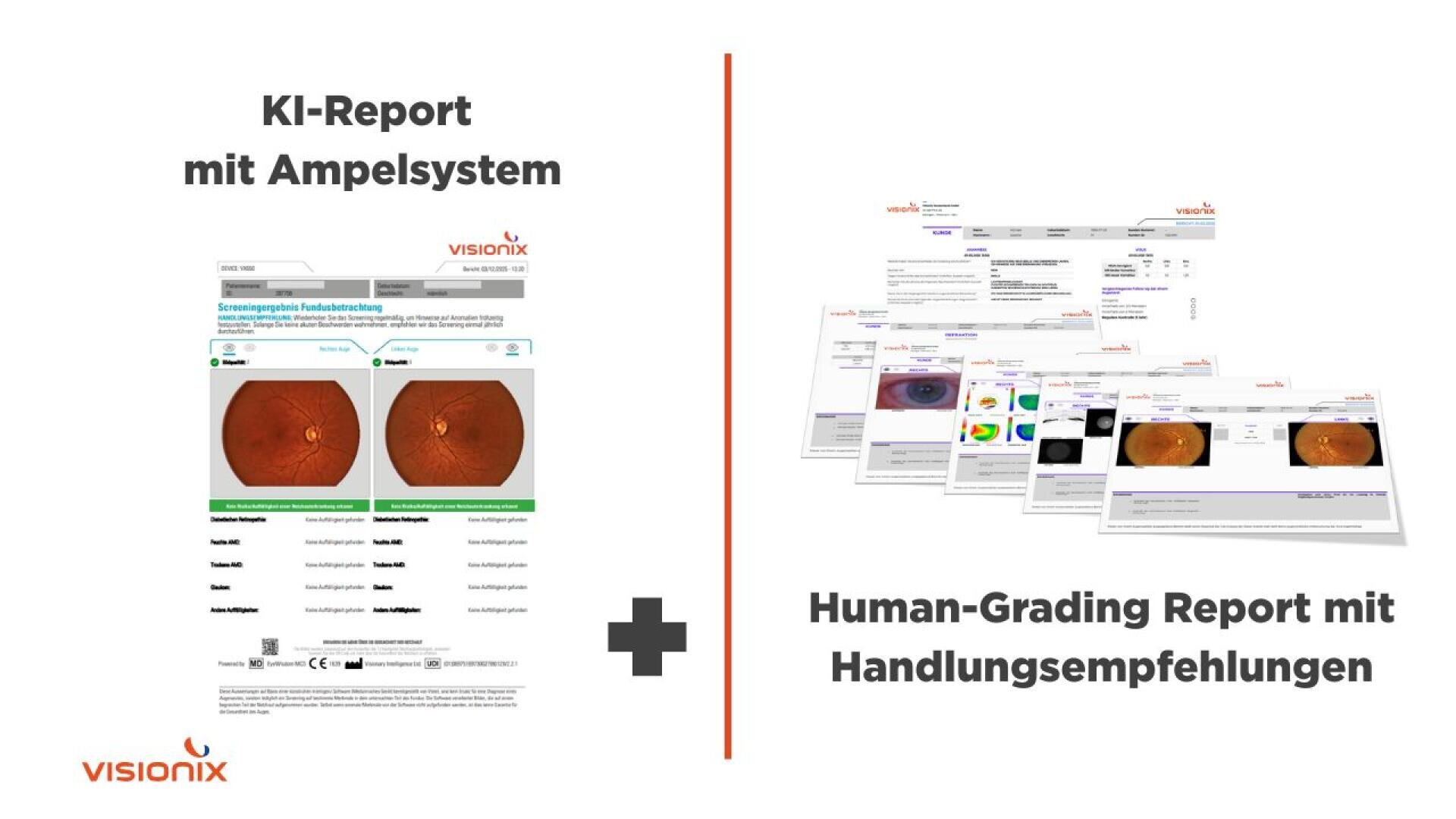 Geteiltes Bild: Links ein KI-generierter Augenuntersuchungsbericht mit einem Ampelsystem, das Netzhautbilder zeigt. Rechts: ein Stapel menschlicher Bewertungsberichte für die Augengesundheit mit Empfehlungen. Das Visionix-Logo erscheint darunter.
