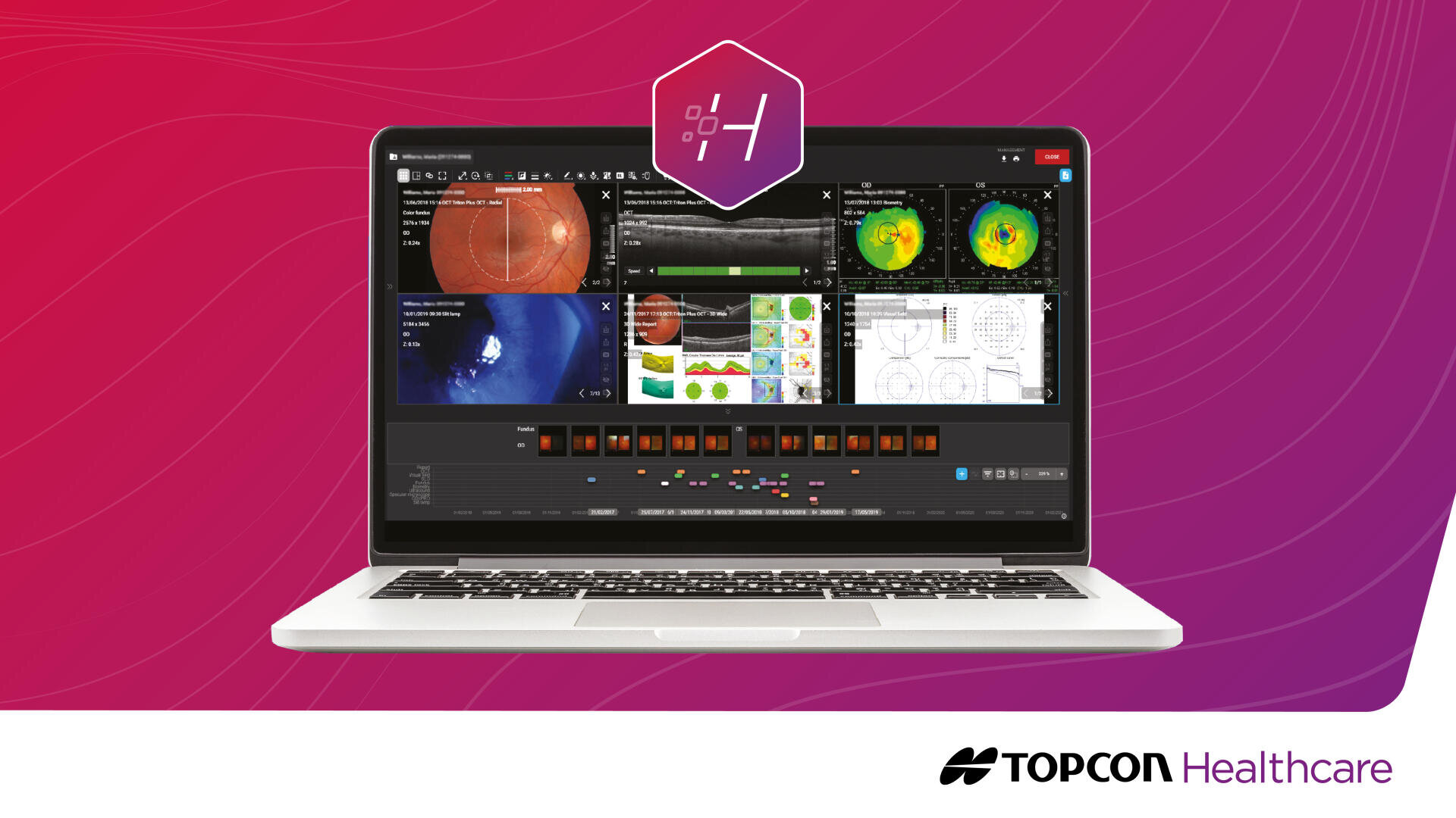 Ein Laptop, auf dessen Bildschirm verschiedene ophthalmologische Bilder und Augenscans angezeigt werden, vor einem rosa Hintergrund mit Farbverlauf und dem Logo von Topcon Healthcare unten rechts.