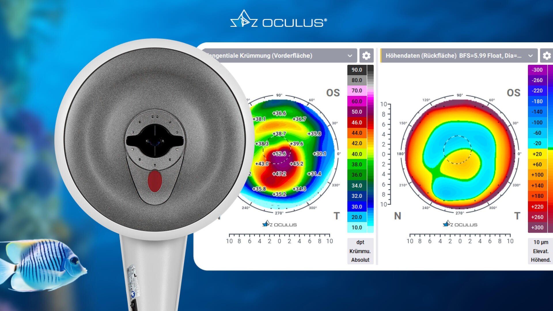 Auf einem Bildschirm werden ein diagnostisches ophthalmologisches Gerät und zwei farbige topographische Karten der Hornhautoberfläche eines Auges gezeigt, darüber das OCULUS-Logo und ein Fisch, der in einem blauen Unterwasserhintergrund schwimmt.