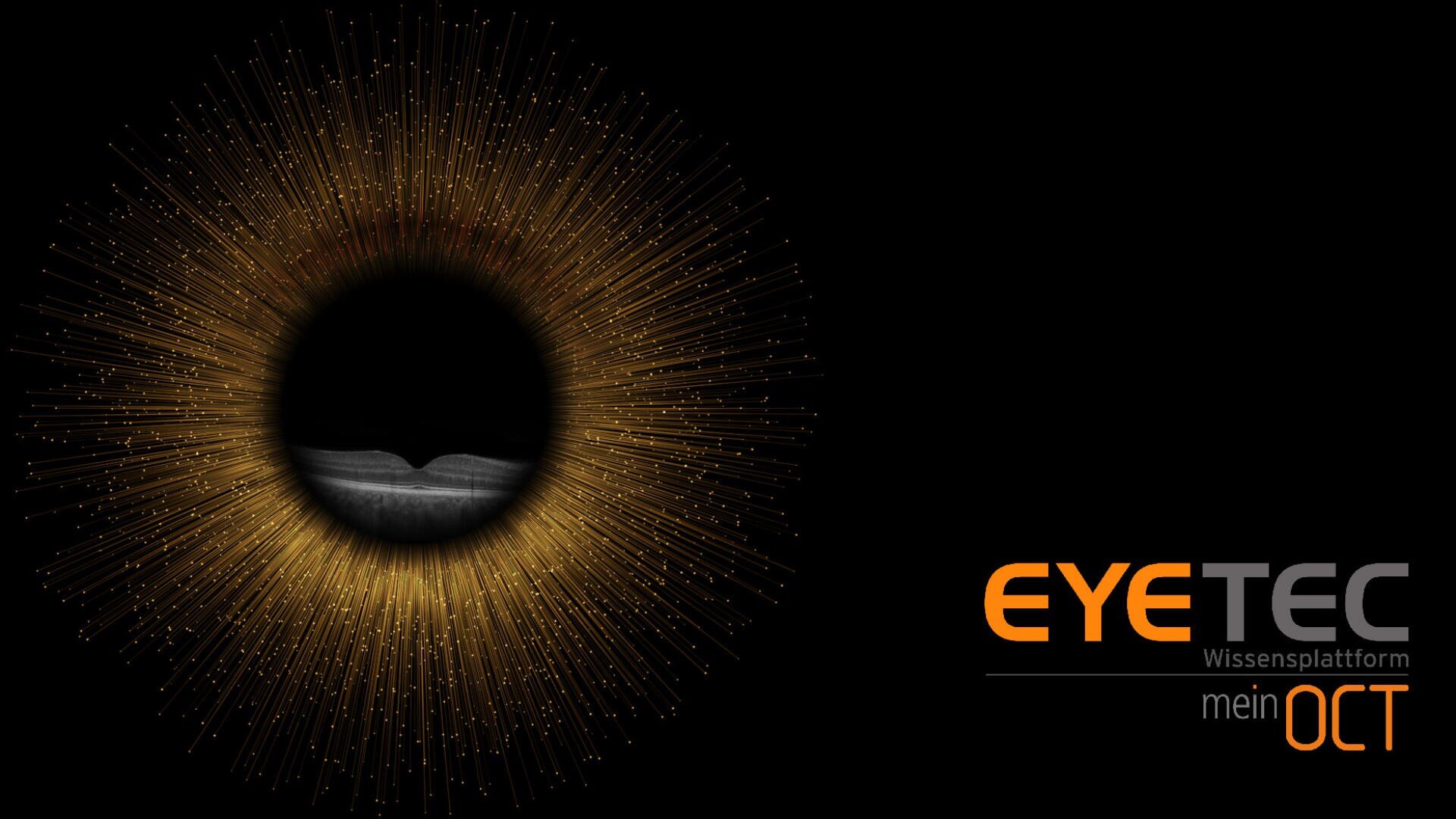 Ein kreisförmiger, goldener Blitz, der einer Iris ähnelt, umgibt in der Mitte einen Graustufen-Augenscan. Rechts steht auf schwarzem Hintergrund der Text „EYETEC Wissensplattform mein OCT“.