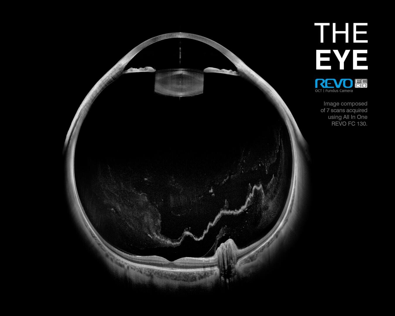 Schwarzweiß-OCT-Scanbild, das einen Querschnitt eines menschlichen Auges zeigt. Auf der rechten Seite sind THE EYE, REVO OCT und zusätzlicher Text zum Scanmodell zu sehen. Die inneren Augenstrukturen sind deutlich sichtbar.