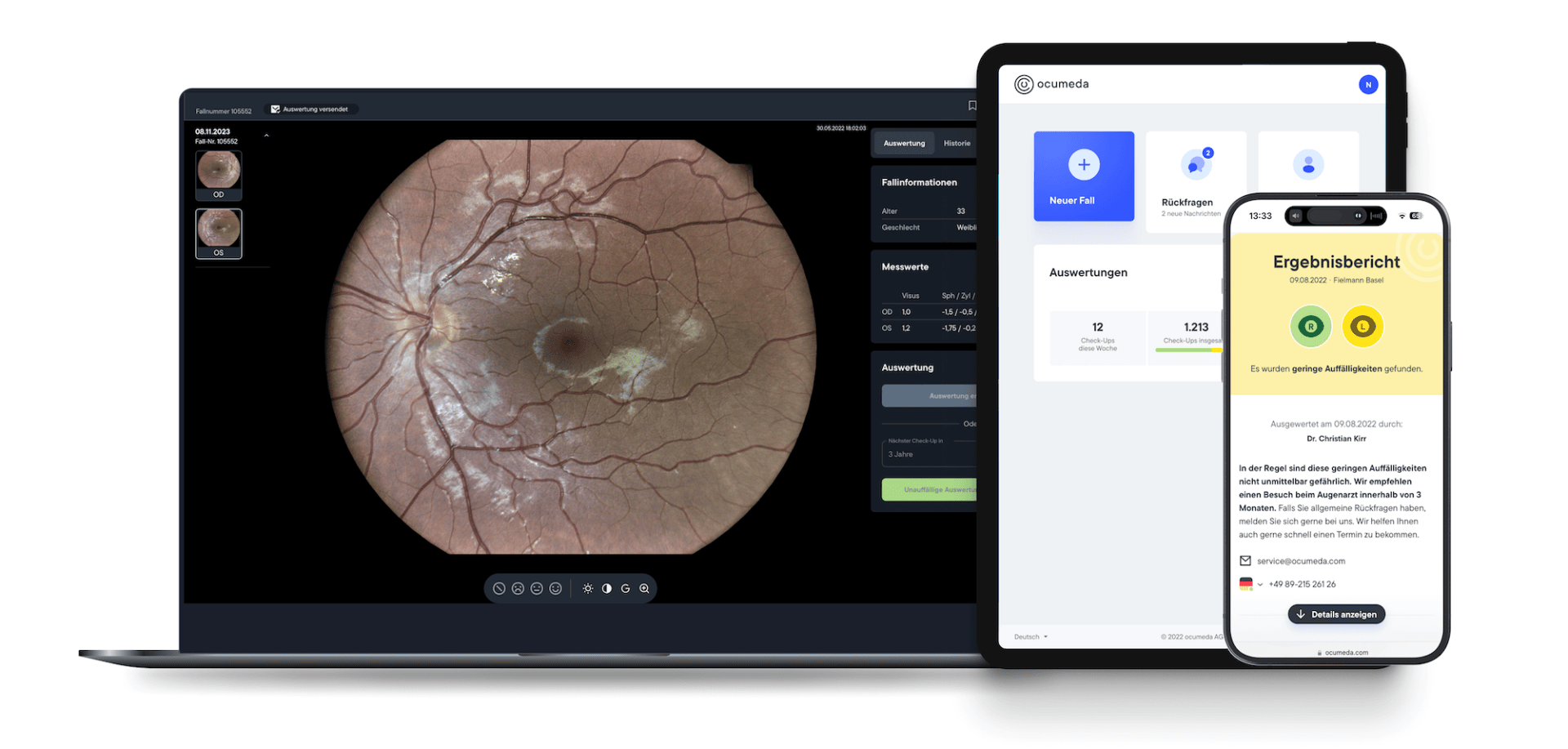 Ein Laptop zeigt ein Netzhautscanbild mit Analysetools an, während ein Tablet und ein Smartphone ein digitales medizinisches Ergebnis-Dashboard auf Deutsch anzeigen.