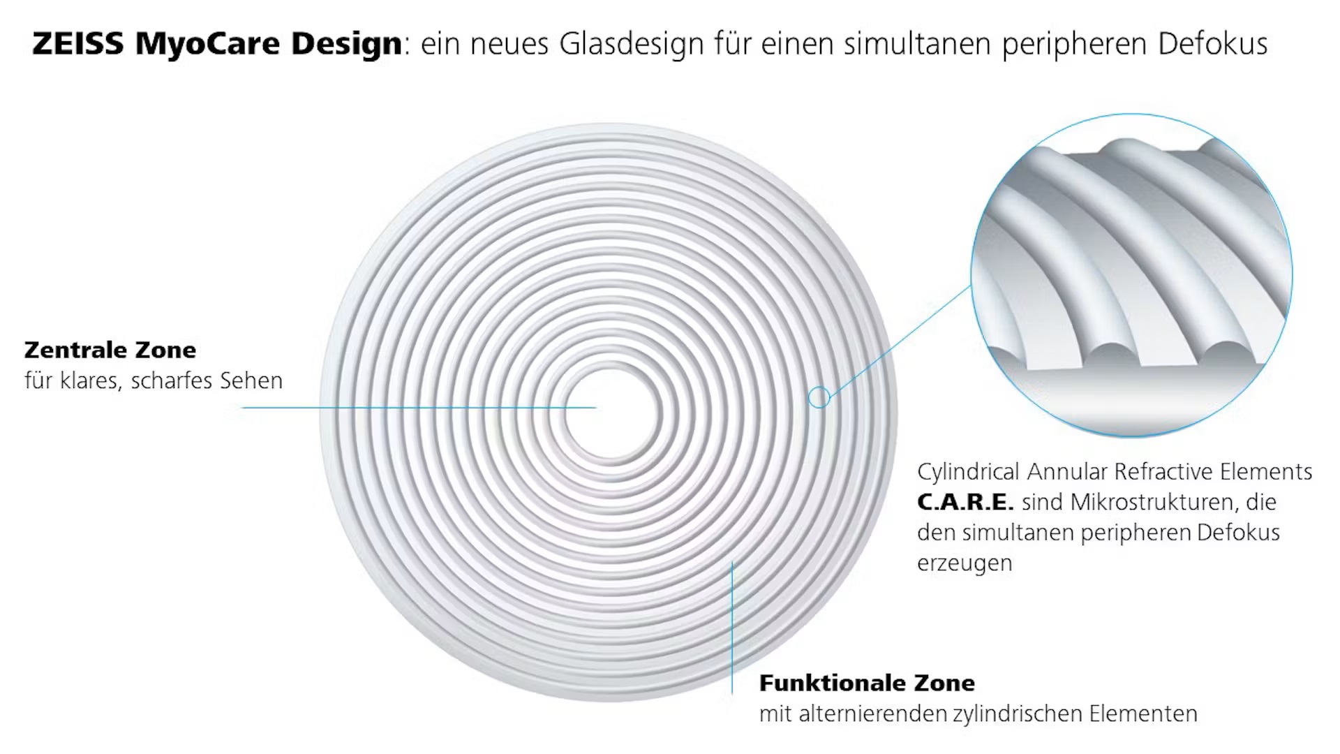 ZEISS MyoCare Design