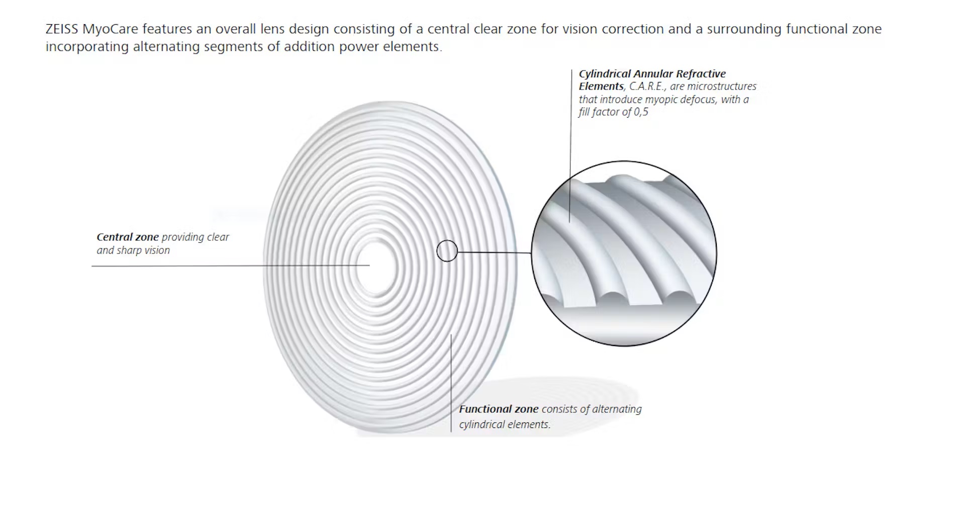 ZEISS MyoCare Design