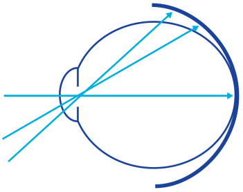 Ein Diagramm mit einem großen blauen Kreis, der von mehreren geraden türkisfarbenen Pfeilen durchschnitten wird, die strahlenförmig nach außen verlaufen, und einem sich überlappenden kleineren blauen Kreis auf der linken Seite.